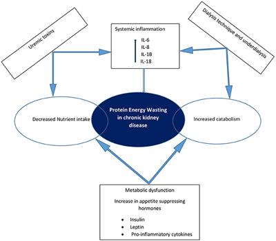 Frontiers | Malnutrition In Chronic Kidney Disease